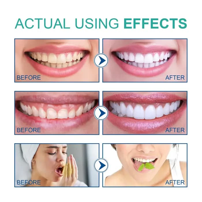 Bain de bouche à l'huile de coco sans alcool, protège la santé dentaire, rafraîchit l'haleine et élimine les résidus alimentaires.